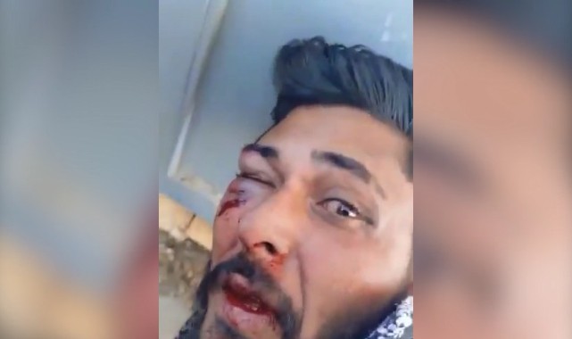 Şanlıurfa’da kız çocuğunu taciz ettiği iddia edilen genç dövülüp jandarmaya teslim edildi