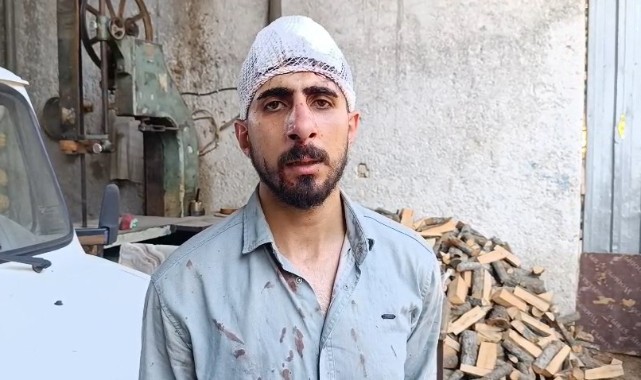 Şanlıurfa’da ‘yavaş gidiyorsun’ dayağı: Sürücünün burnu kırıldı, başına 8 dikiş atıldı