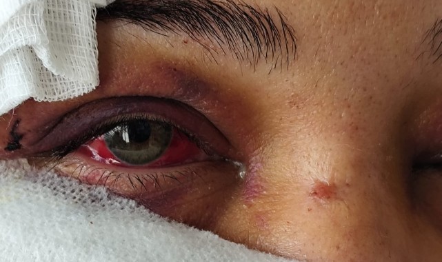 Cumhurbaşkanlığı korumasından eşe şiddet iddiası:“Güzelliğini elinden alacağım, yarım kalan işi tamamlayacağım”