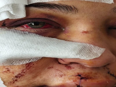 Şanlıurfa'da yaralı kartal tedaviye alındı